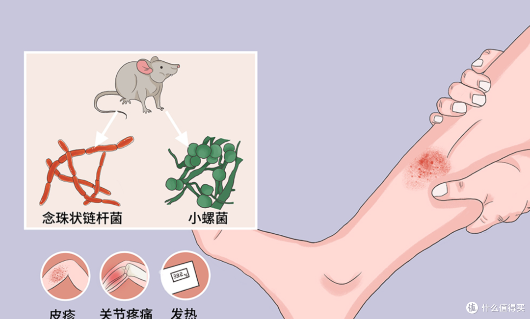 男子被老鼠咬10天后高烧，被确诊为鼠咬热