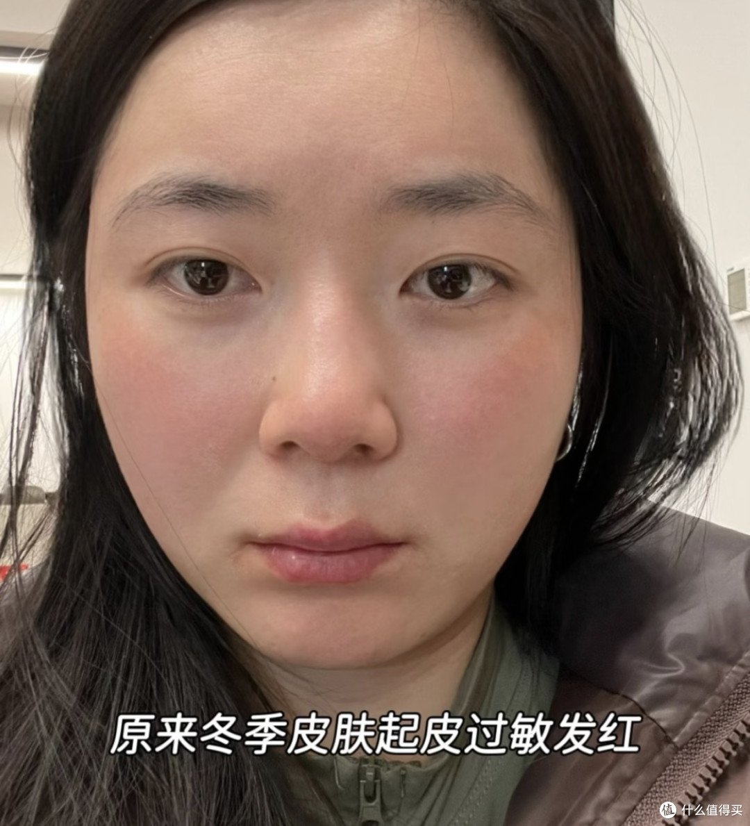30+ 三件事养“厚”脸皮护肤