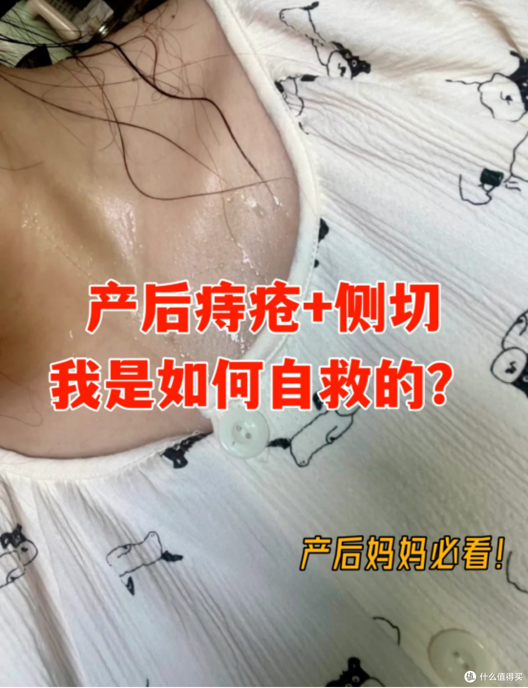产后受痔疮+侧切困扰?新手妈妈必看!