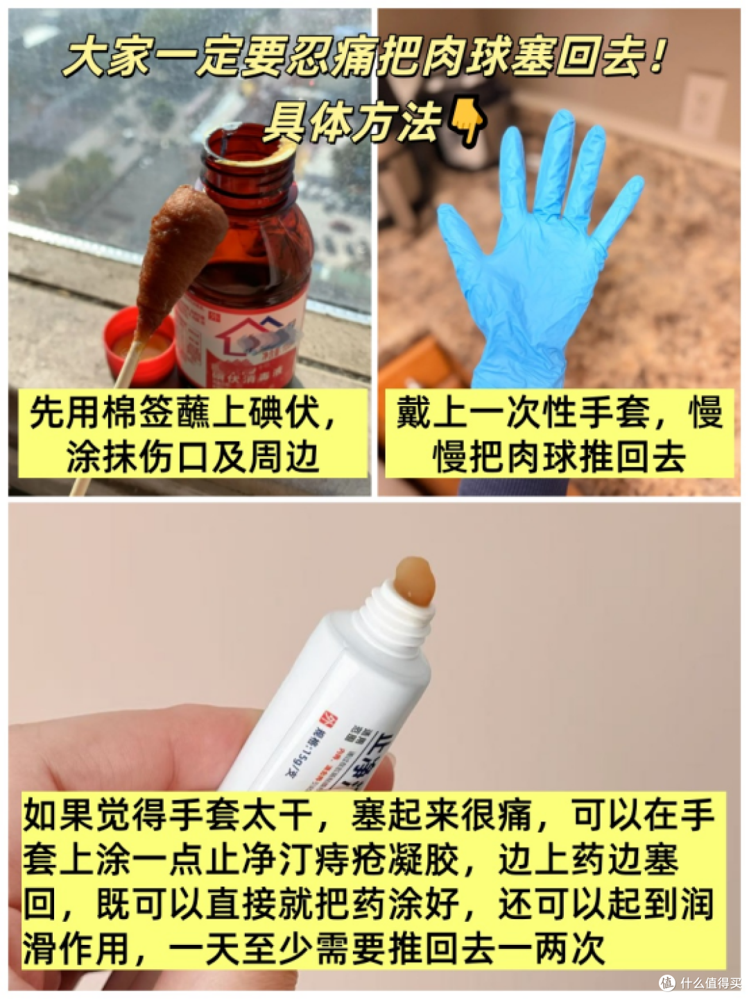 产后受痔疮+侧切困扰?新手妈妈必看!