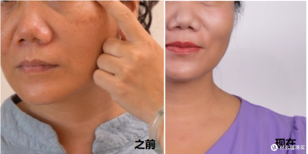 52岁真实淡斑分享:被斑点困扰30年,终于敢素颜出门了|纽莱伊美