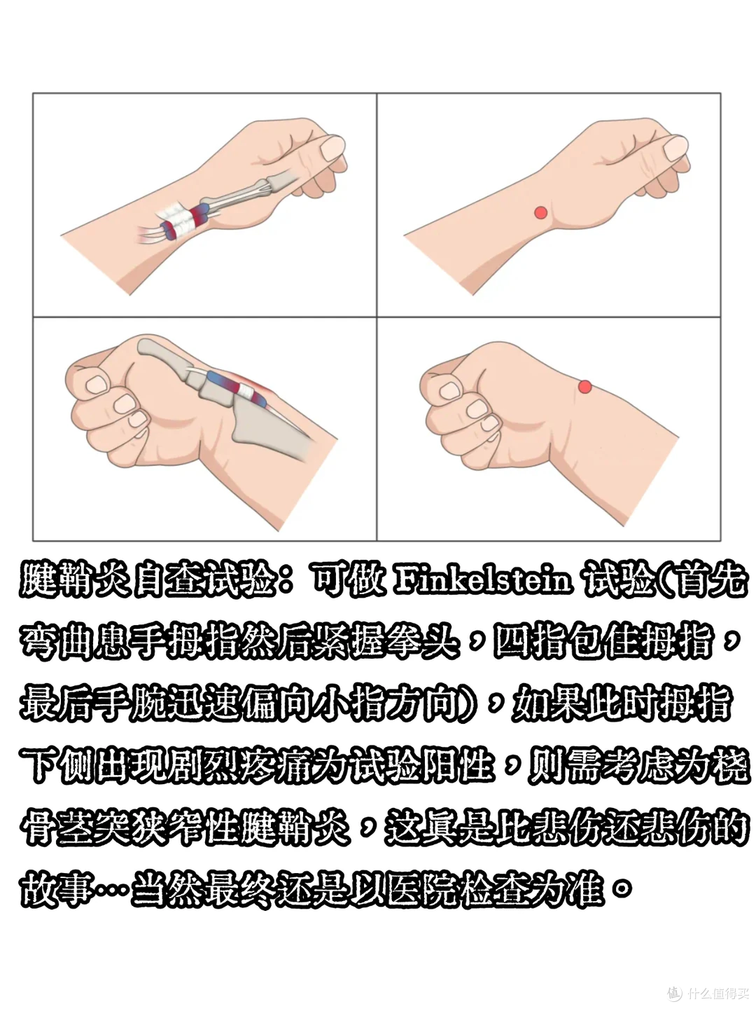 抱娃手腕疼?3分钟学会腱鞘炎缓解法,亲测有效!