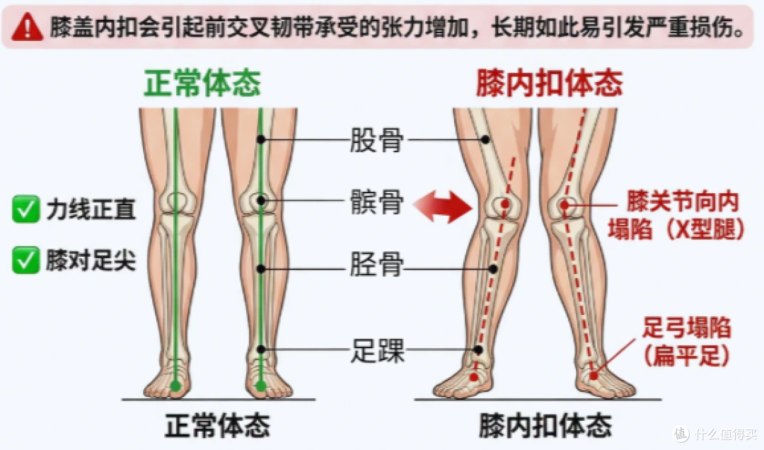 在家练出「铁膝盖」!4 个跑者专属护膝动作,远离跑步伤痛