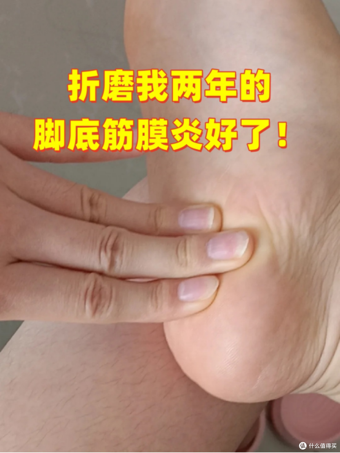 折磨我两年的脚底筋膜炎好了！