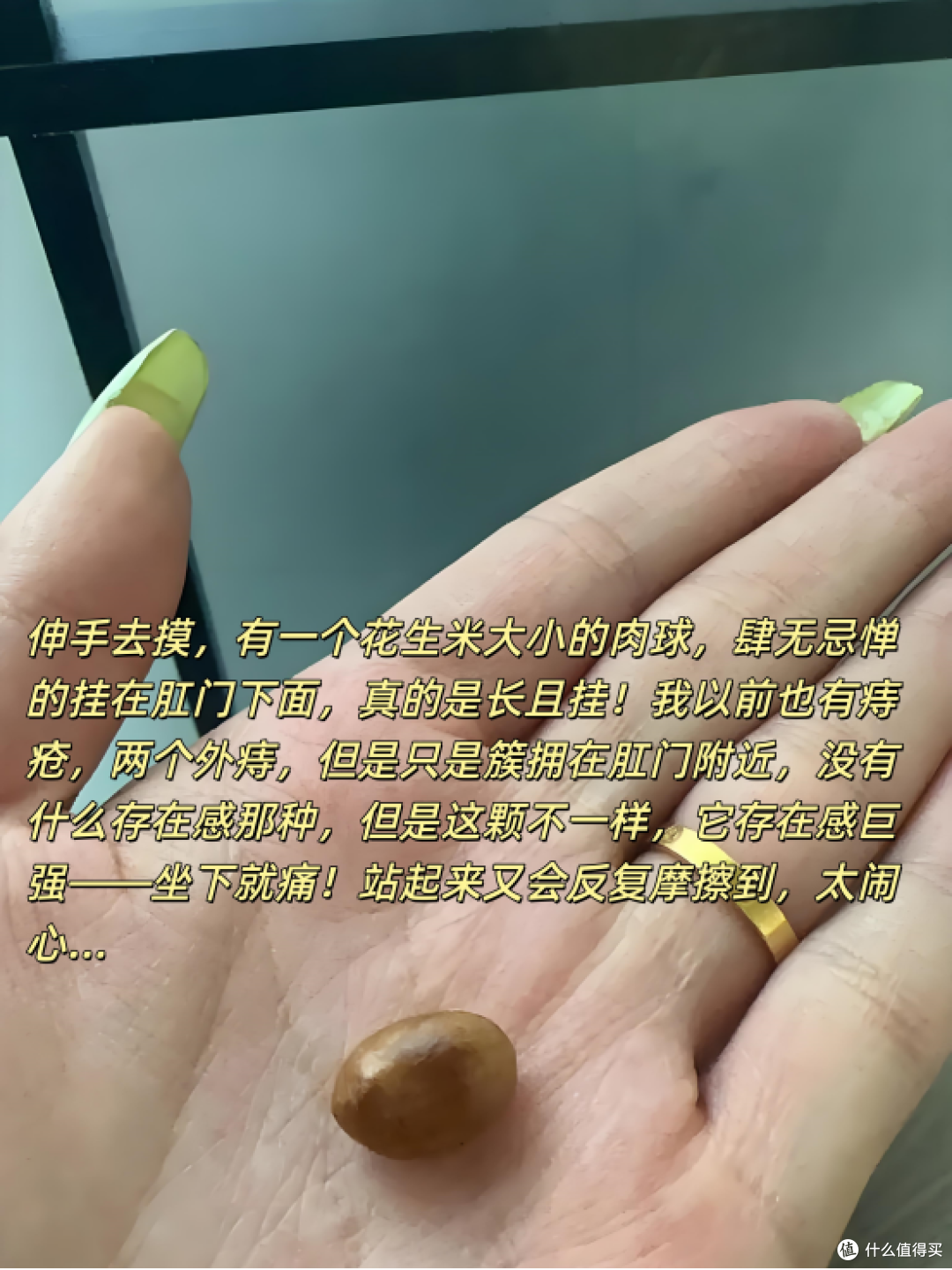 生娃之后,十女九痔在我身上应验了!痛痛痛痛!!!