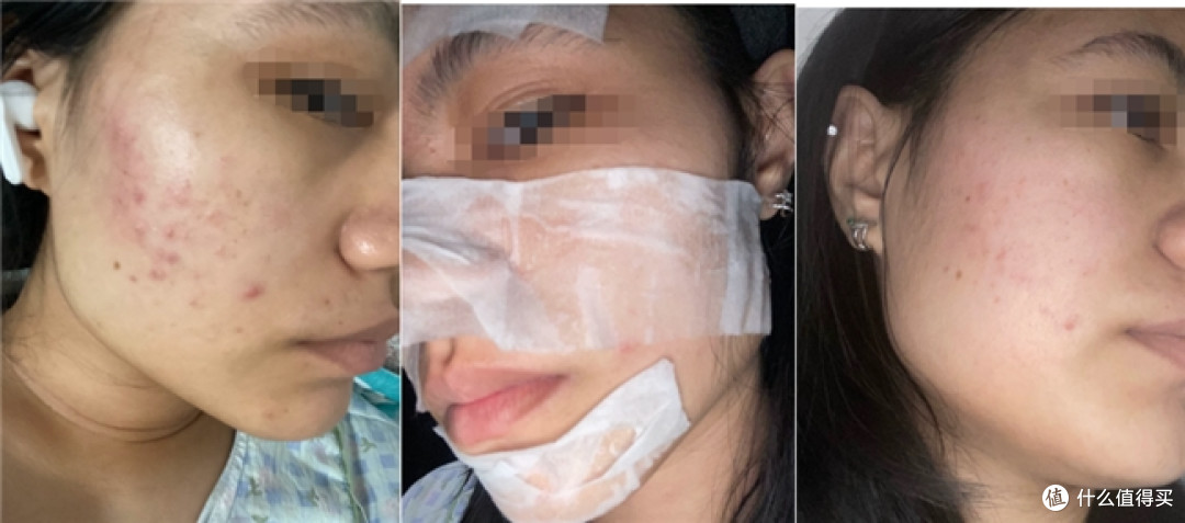 油皮公认好用的爽肤水?全网口碑护肤盘点,质地清爽易吸收
