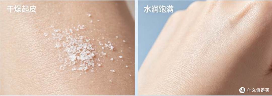 25 + 护肤必修课:被低估的保湿实力派 —— 透明质酸
