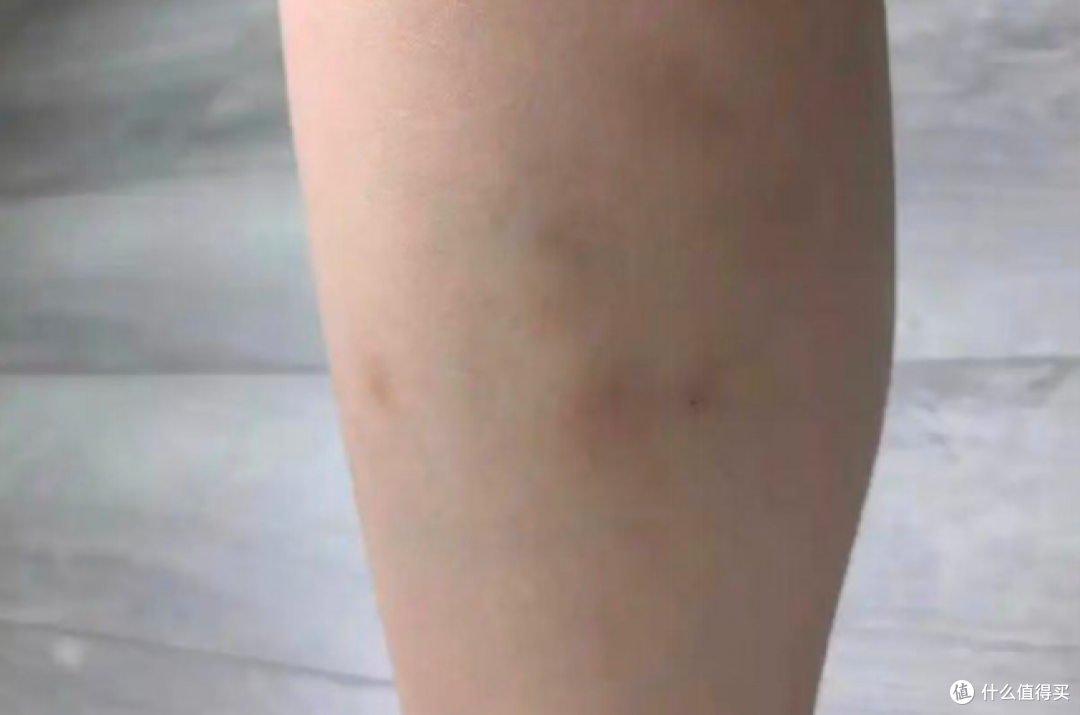 筋膜枪的用处有哪些?有害吗?盘点四大副作用危害
