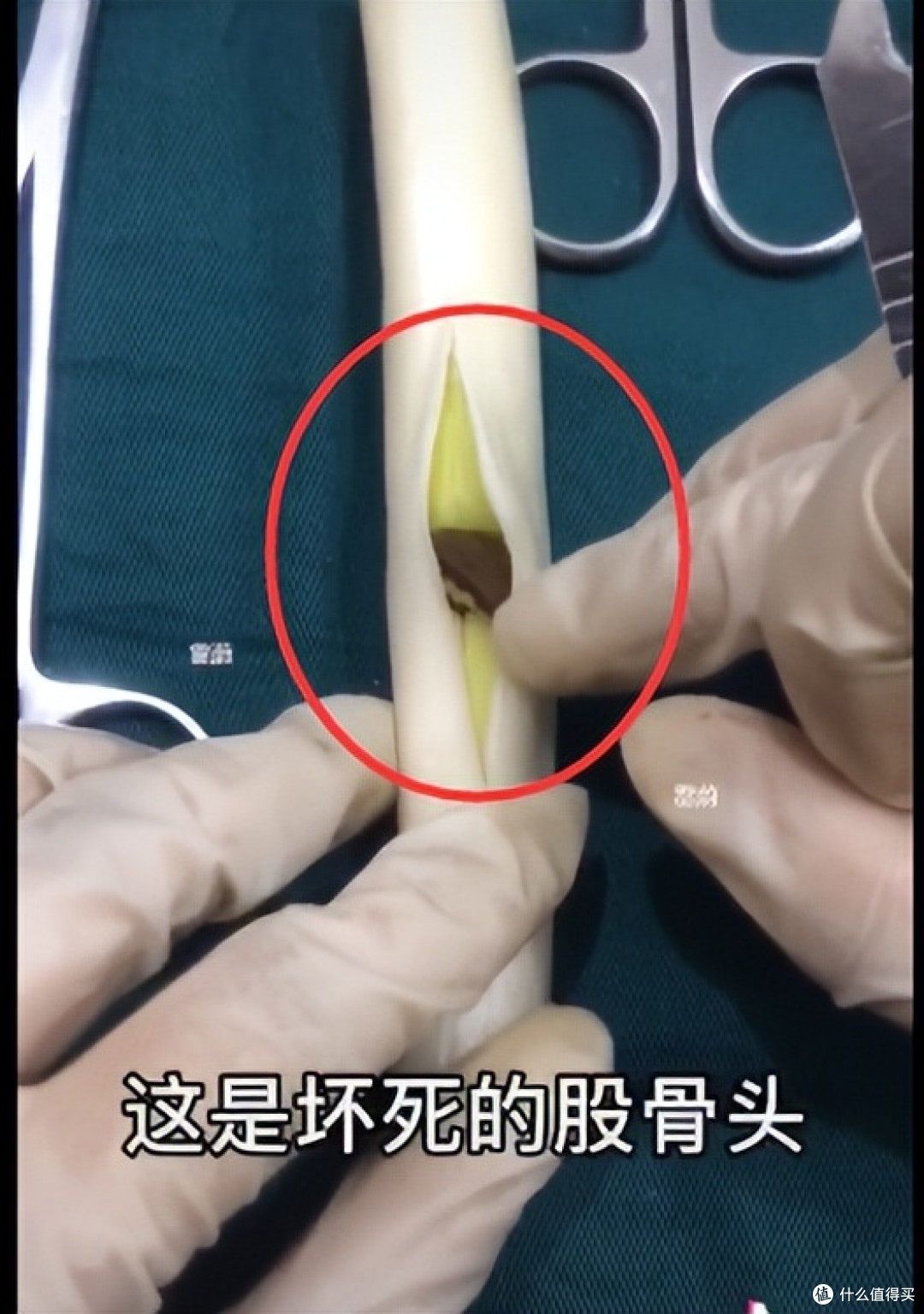当医学生遇上水果，一场神秘“手术”正在酝酿