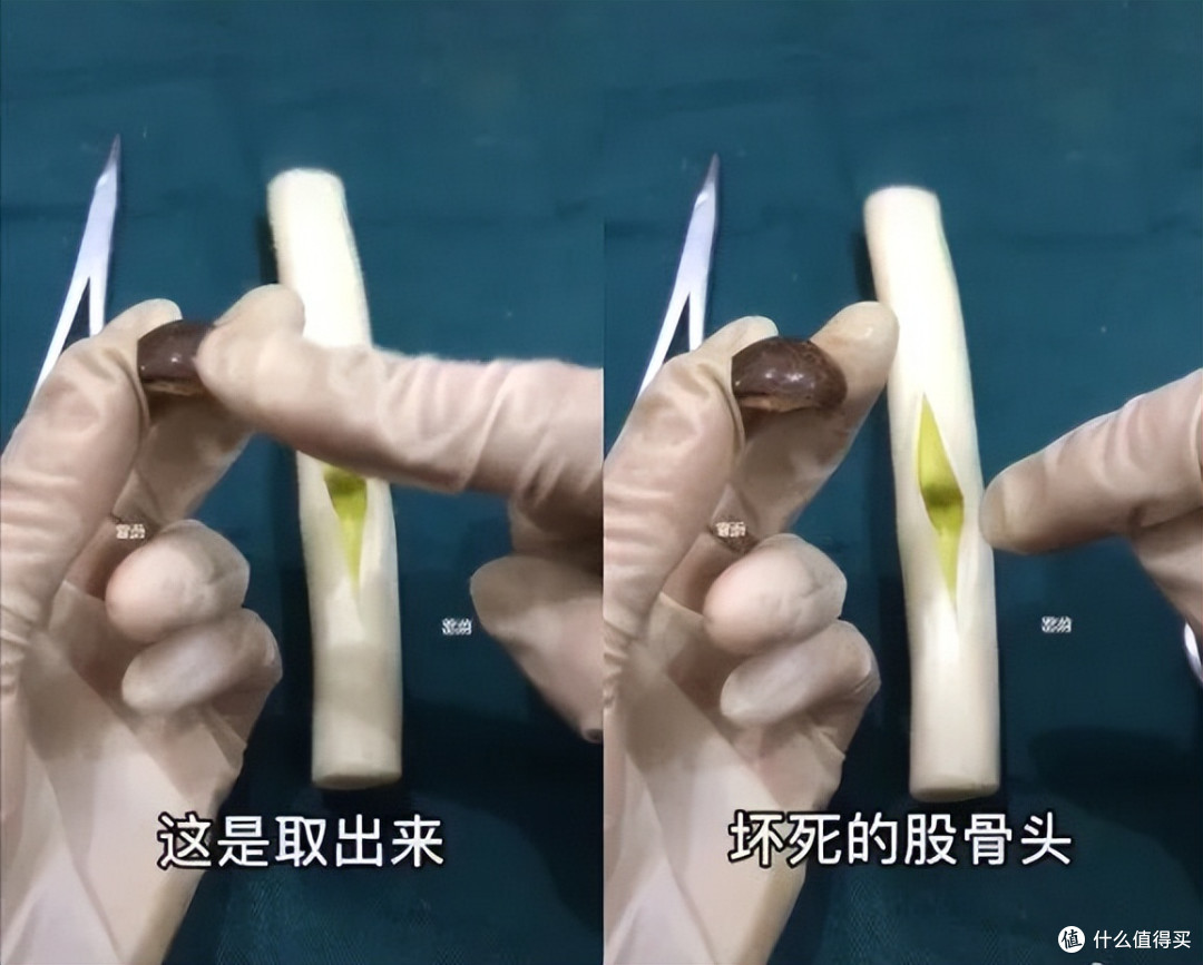 当医学生遇上水果，一场神秘“手术”正在酝酿