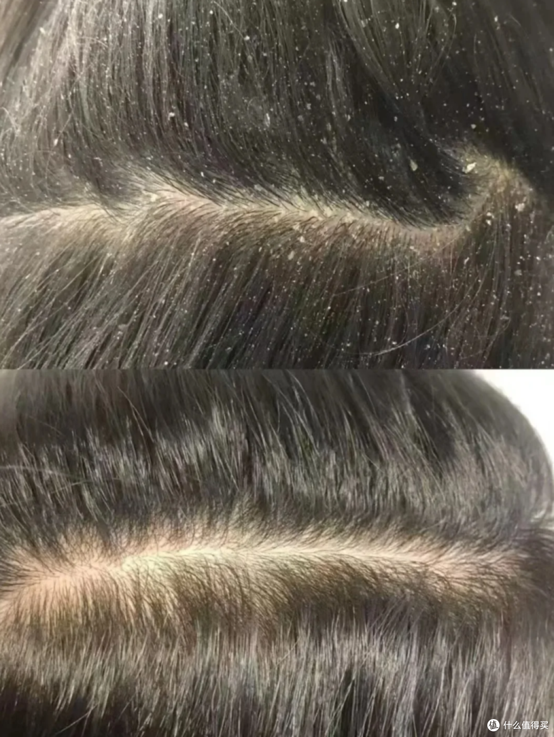 顽固头屑反复不见好?混油皮拉三位不同头皮朋友实测5款洗发水