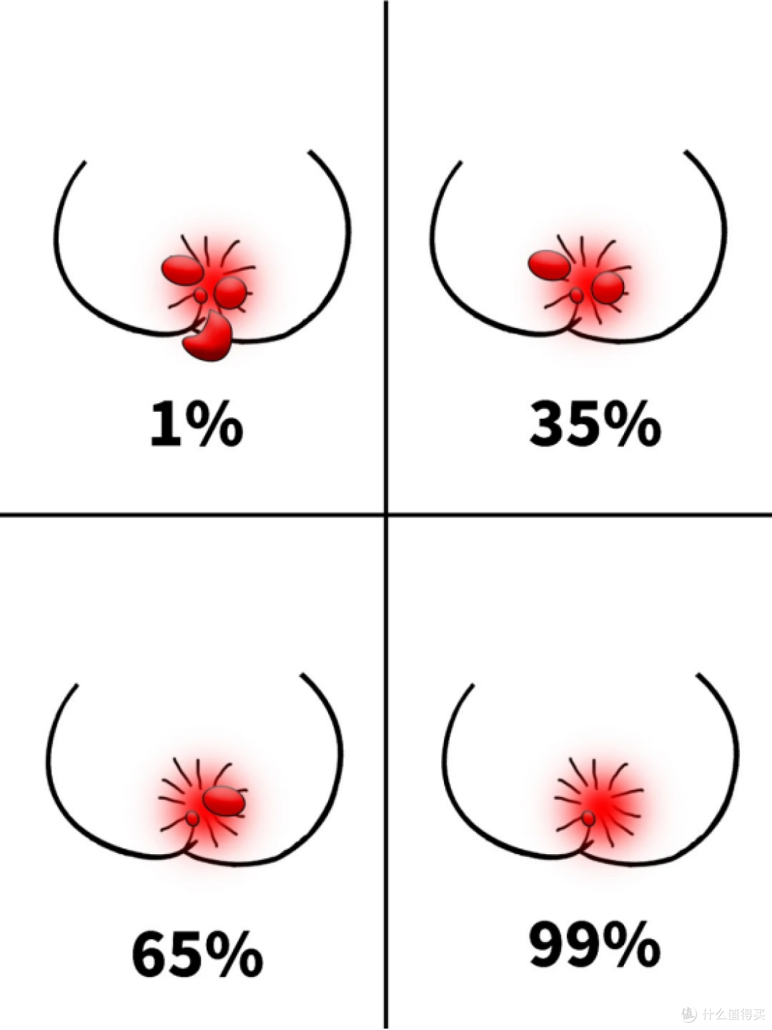 产后痔疮肉球1个月缩小90%!