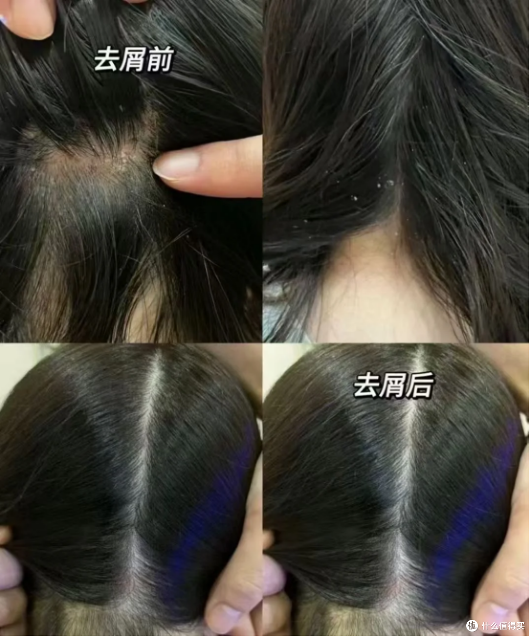 盘点几款止痒去屑实力派洗发水,日常自用超合适