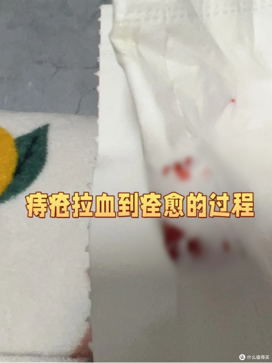 分享一下痔疮拉血到痊愈的全过程
