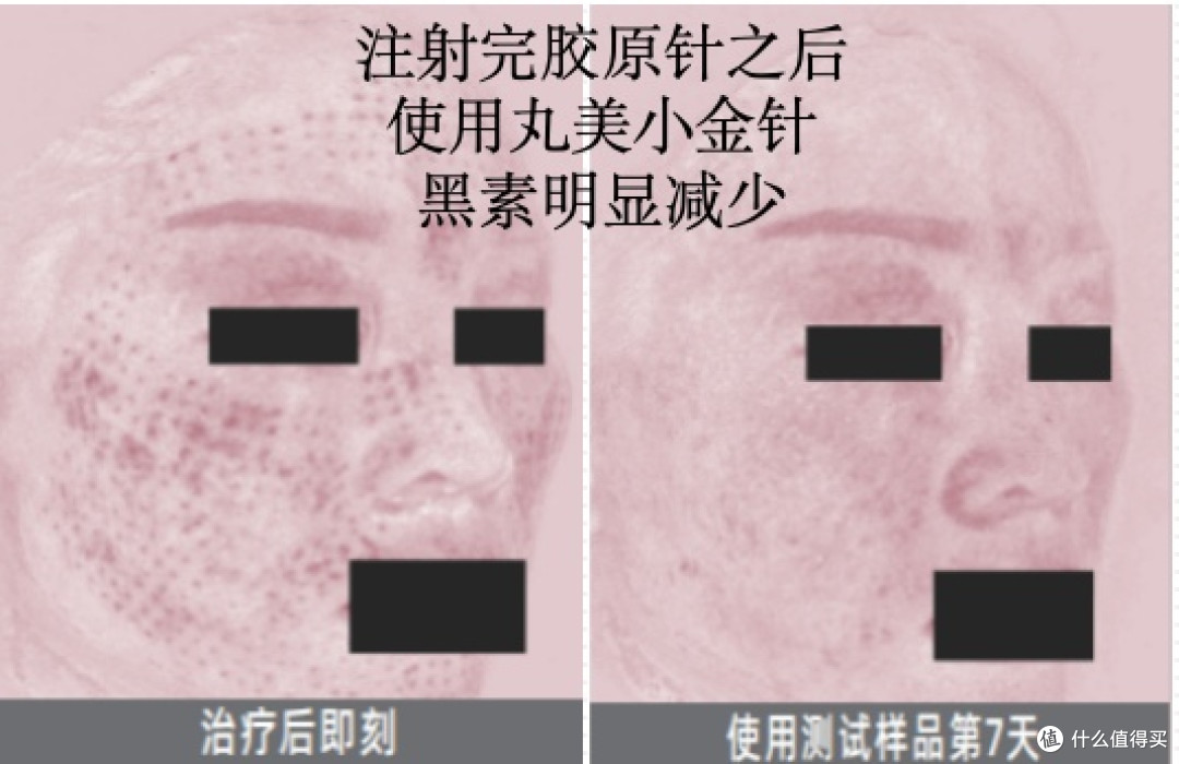 想给妈妈买护肤品,推荐买什么牌子的?新一代丸美胶原小金针精华
