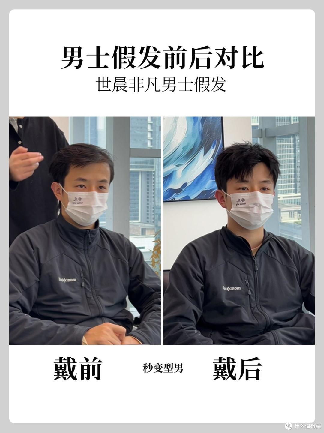 男士假发定制哪家靠谱？全国直营连锁终身售后，定制更省心