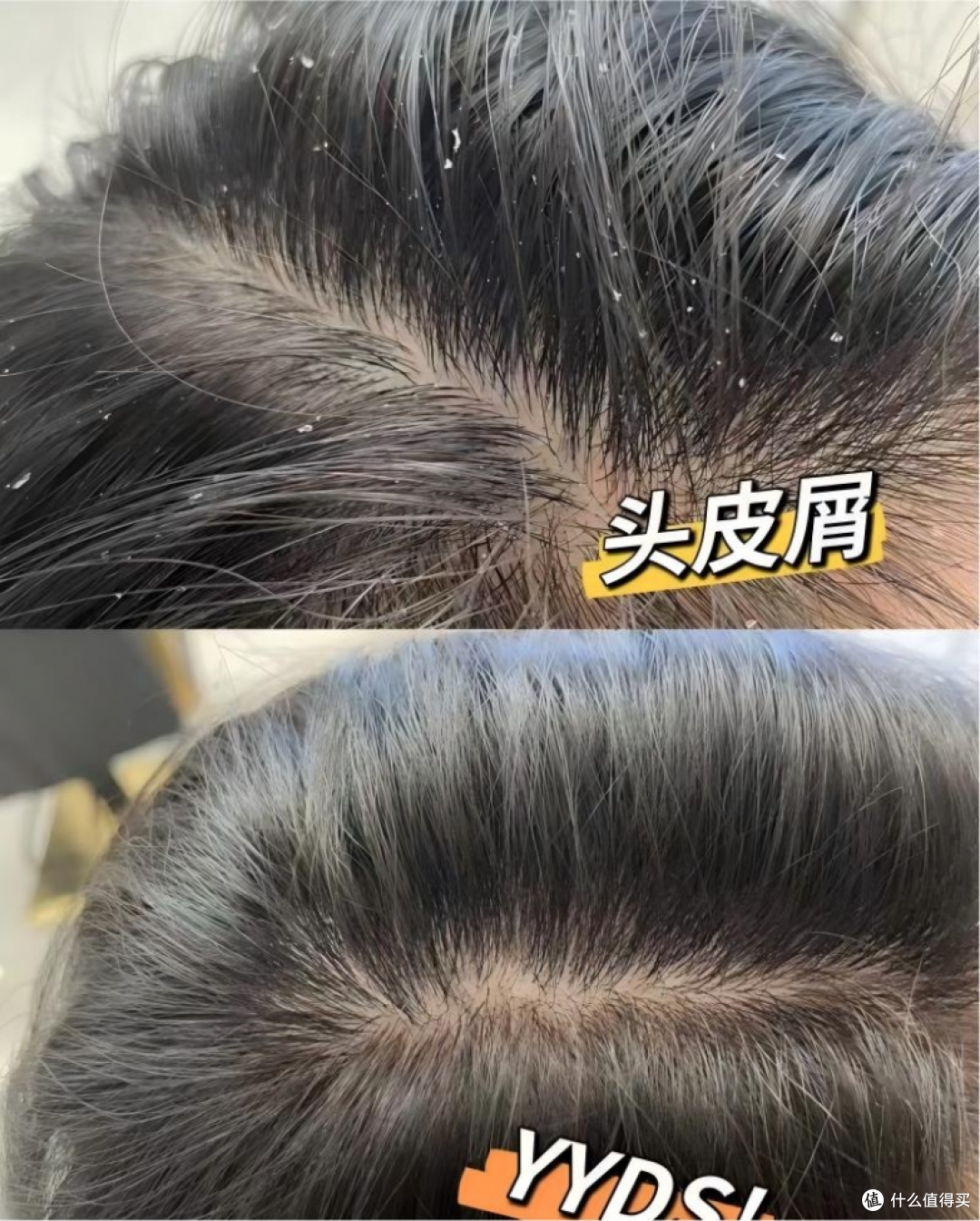 什么洗发水去屑止痒效果好?有效去屑止痒洗发水,强效去屑不刺激