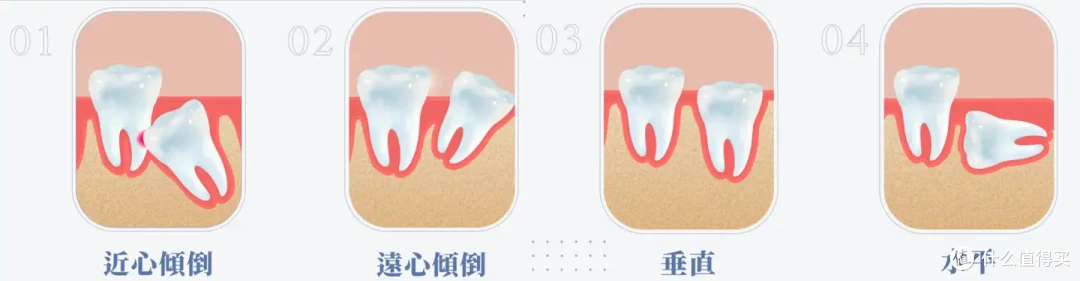 欧可林「氧气啵啵AirPump」冲牙器，怎么给人带去口腔清洁新体验?
