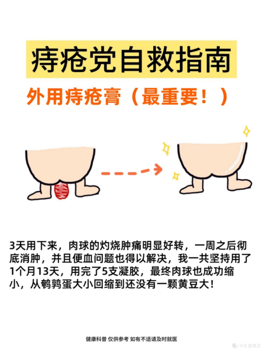 痔疮党自救指南,每天5分钟,和痔疮说拜拜~