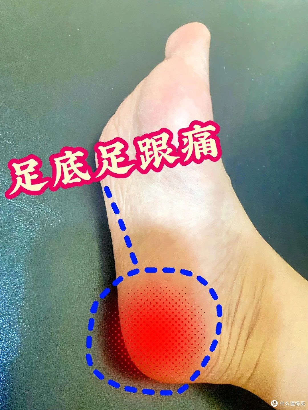 足底筋膜、足跟痛如何缓解!