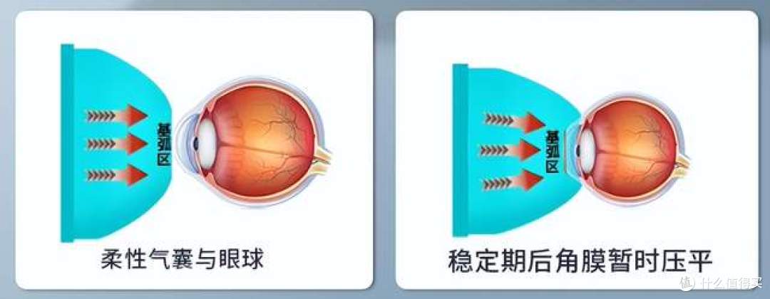 给孩子近视踩踩刹车:别让十年沉淀,变为一触即“镜”的未来!