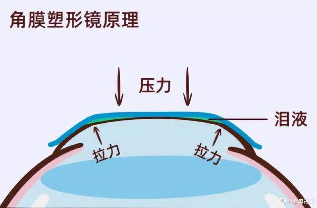 给孩子近视踩踩刹车:别让十年沉淀,变为一触即“镜”的未来!