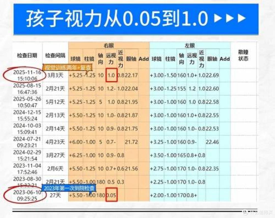 佛山爱尔眼科李亮亮博士,助4岁弱视宝宝视力从0.05逆袭至1.0