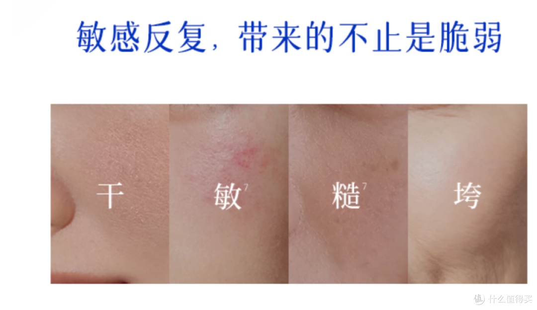 脆皮脸的一罐底气:敏感肌日常维稳口粮面霜怎么选