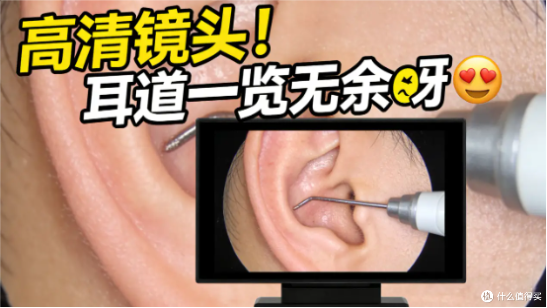 干耳怎么掏耳朵?油耳用什么掏耳朵比较好?适合油耳朵清理的工具