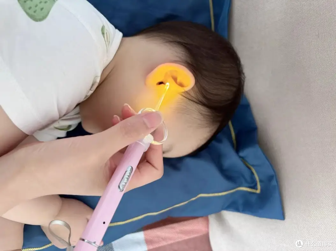 儿童可以用挖耳勺吗?儿童挖耳勺哪个牌子好用?儿童掏耳朵工具
