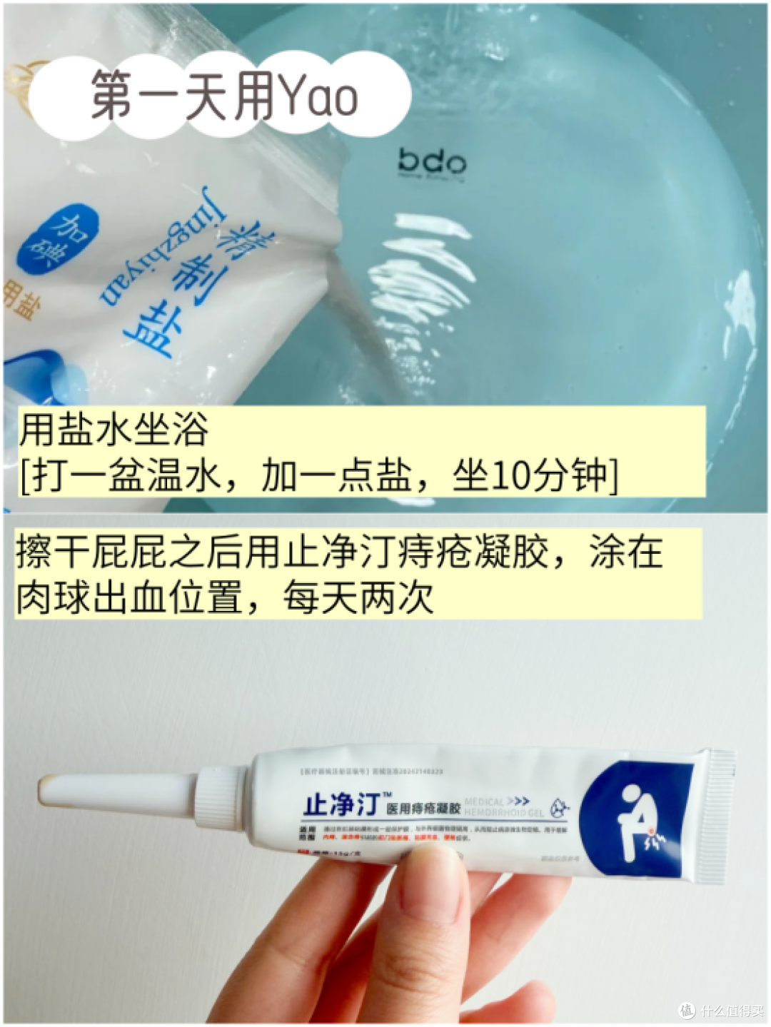 痔疮复发自救指南(个人记录贴)