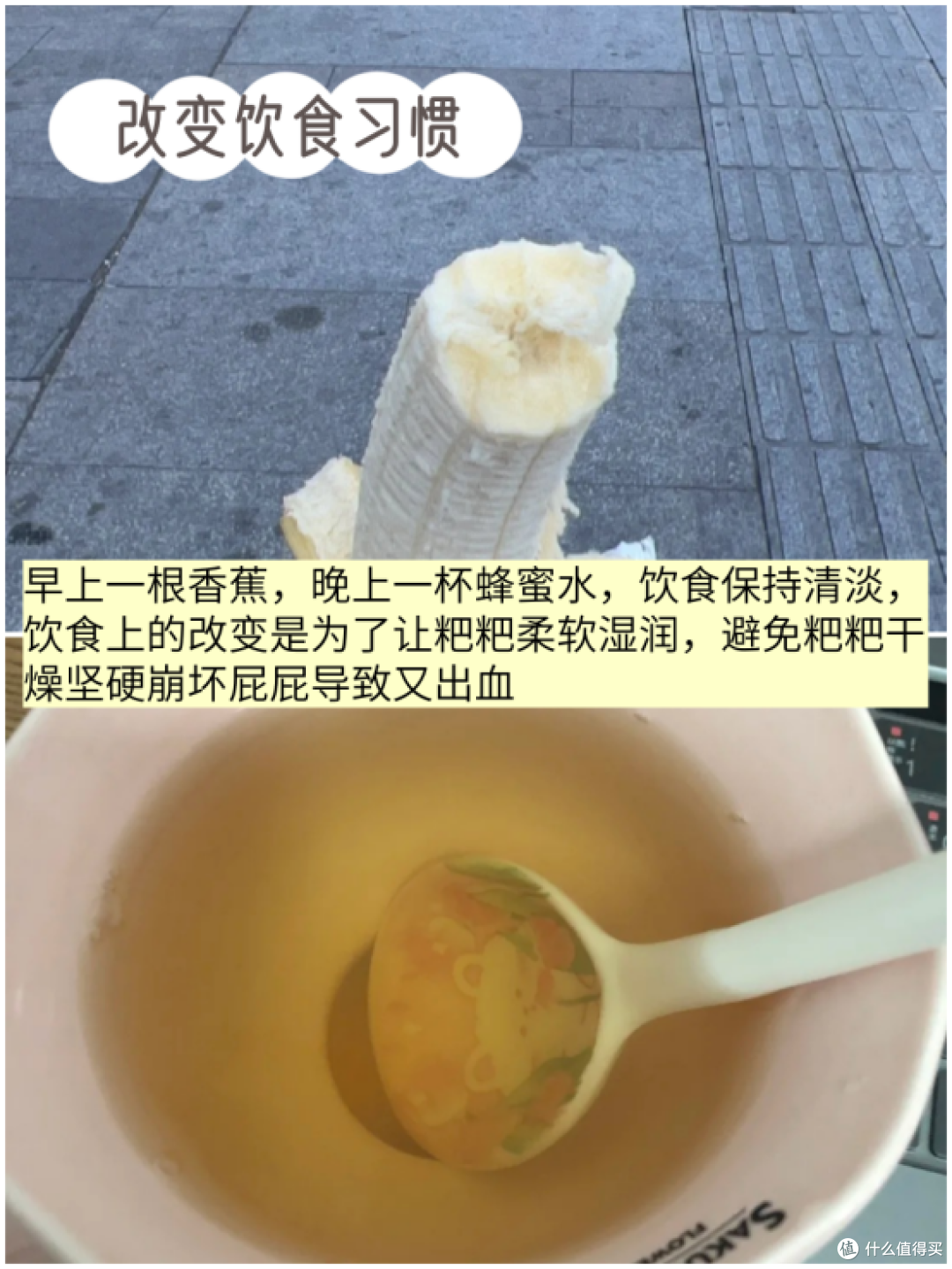 痔疮复发自救指南(个人记录贴)