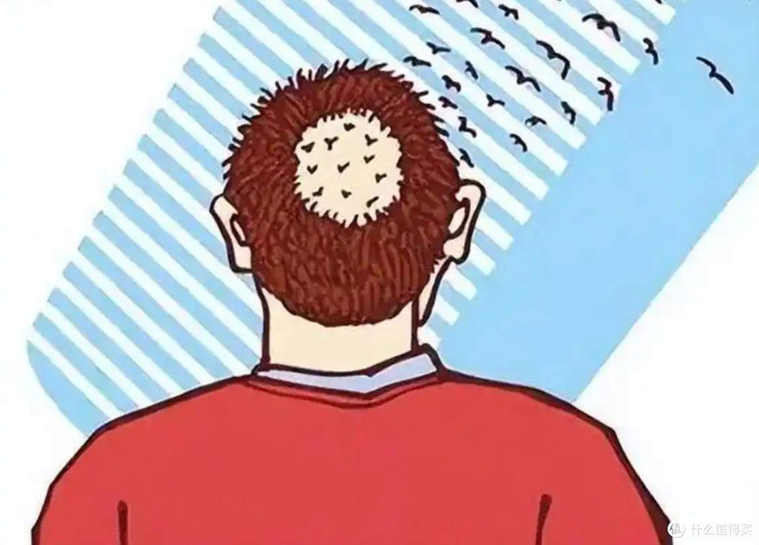 斑秃怎么调理_黑奥秘四大专利成分促进毛囊健康