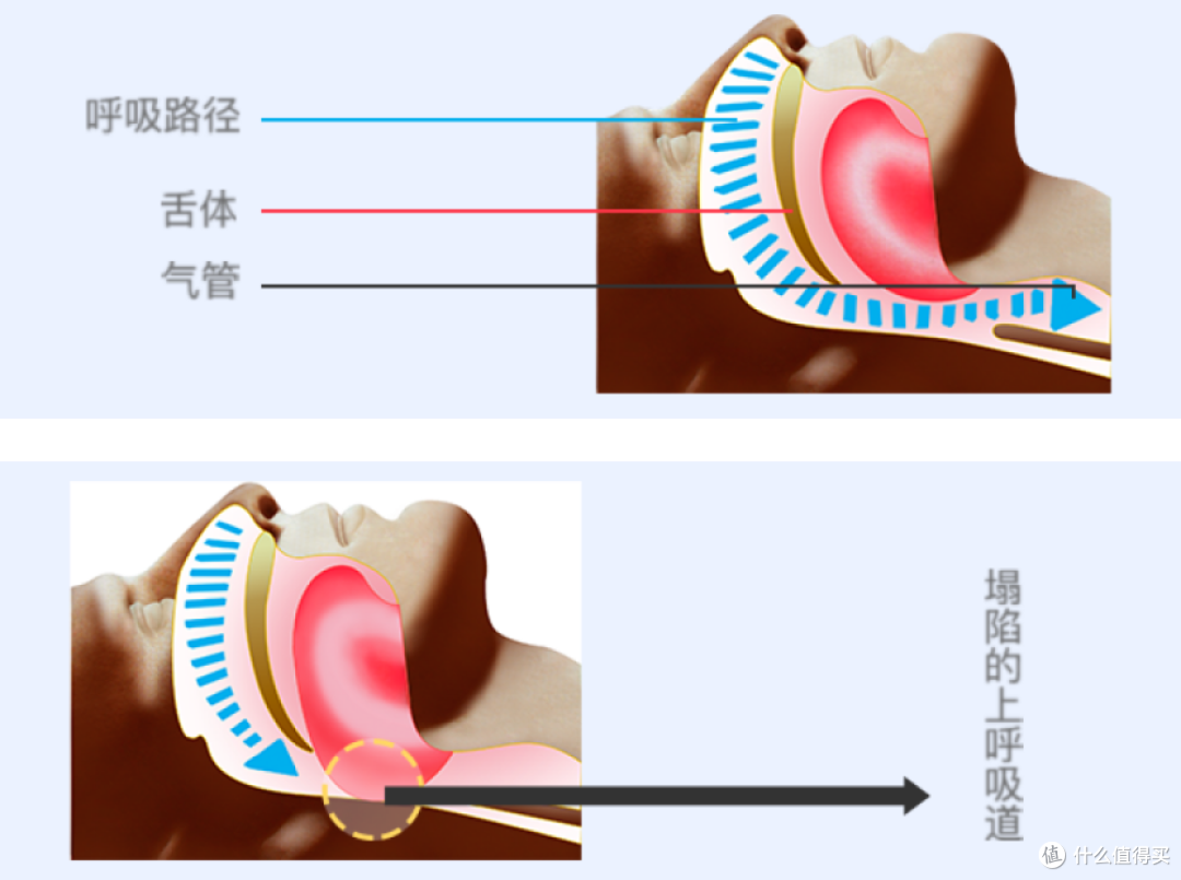 “让老公闭嘴”后续|瑞迈特E5用满一年,3000字真实呼吸机止鼾长测