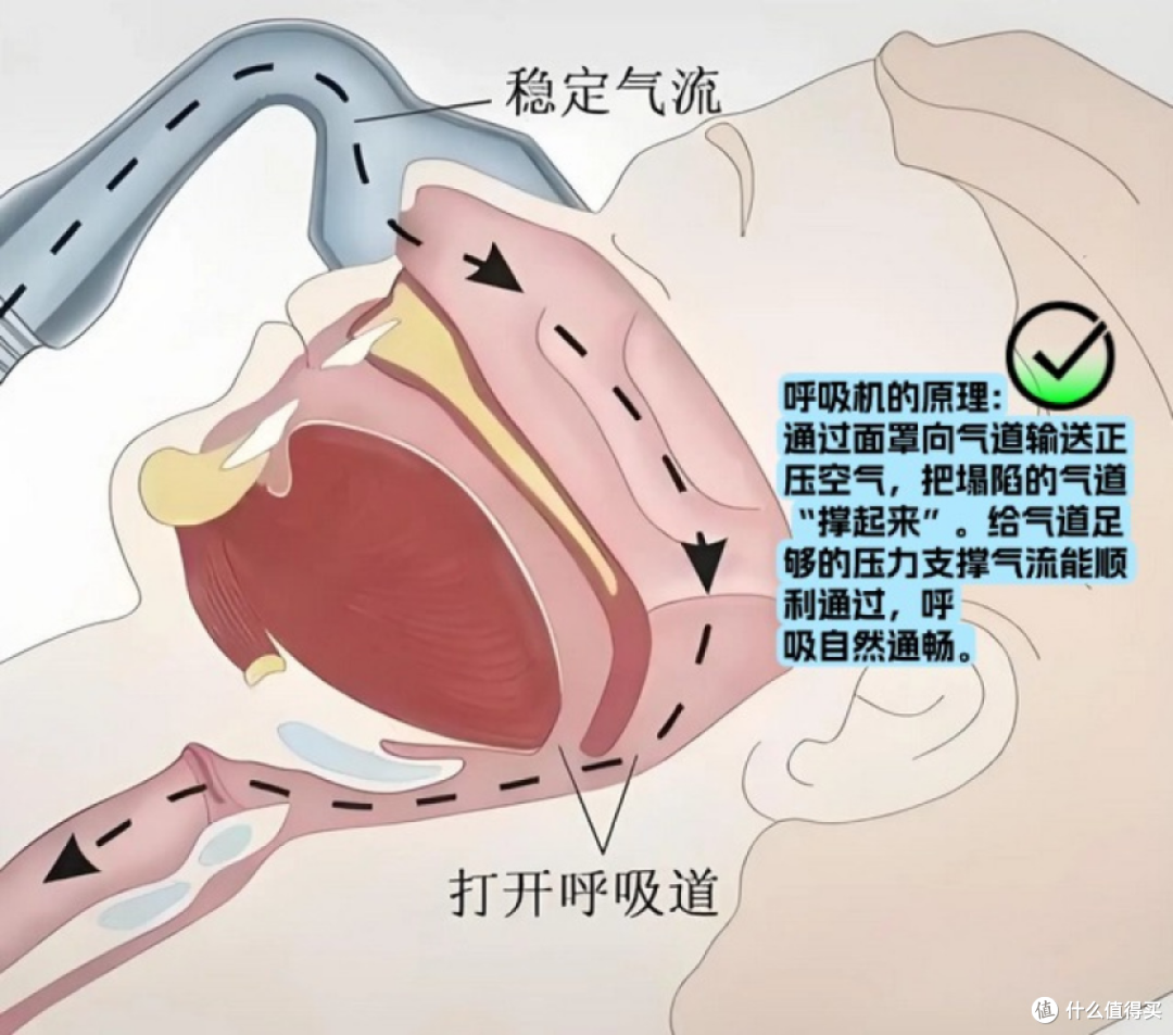 “让老公闭嘴”后续|瑞迈特E5用满一年,3000字真实呼吸机止鼾长测