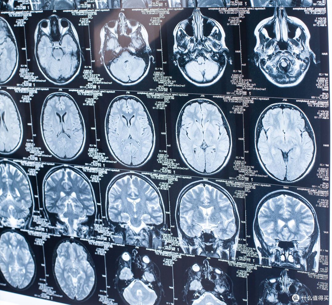 别再死磕 8 小时睡眠了!近 50 万人研究发现,这个时长最抗衰