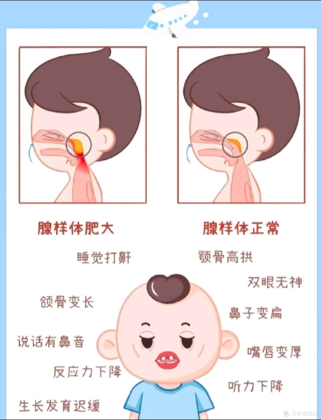 在重庆孩子腺样体肥大哪里可以看