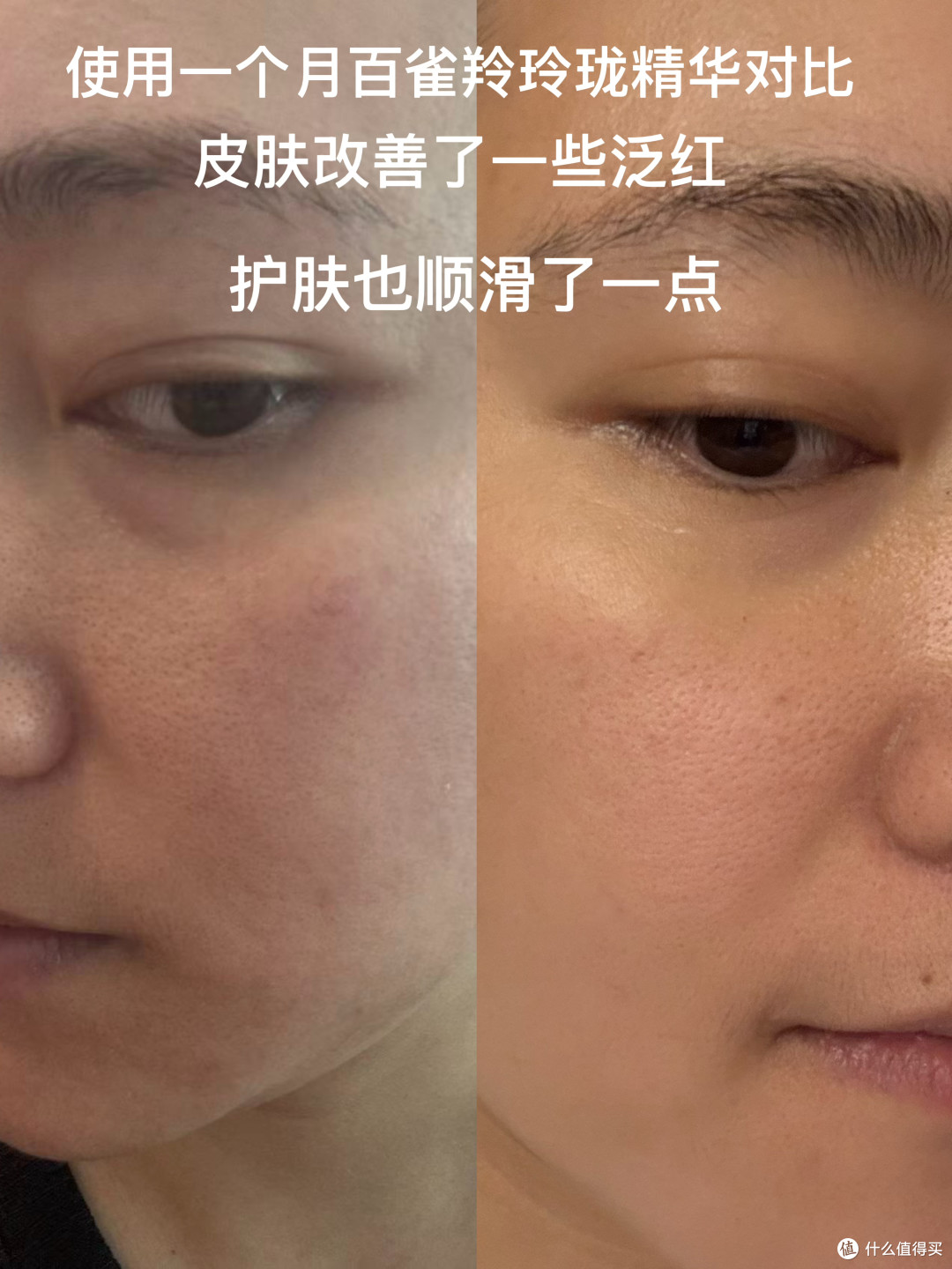 本人使用百雀羚灵珑精华一个月前后对比图