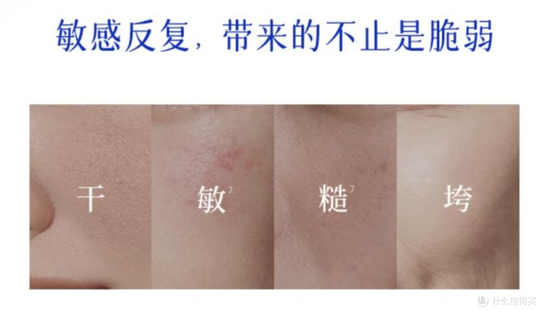 “全皮层蛋白修护”:敏感肌修护新方向,乳铁蛋白+HMO母乳寡糖