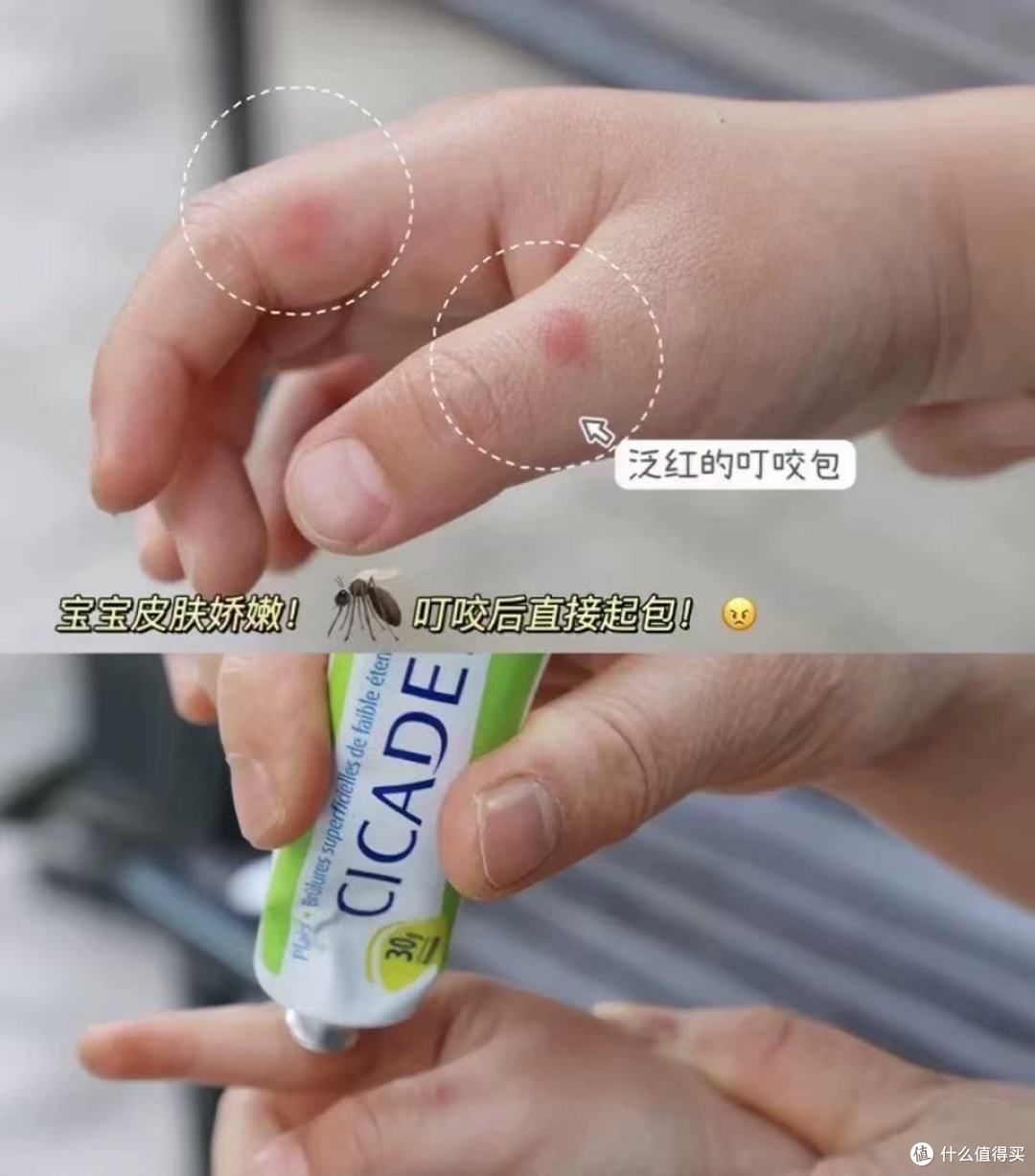夏日带娃必备｜宝宝被叮不哭闹，全靠这支宝弘小绿管✨