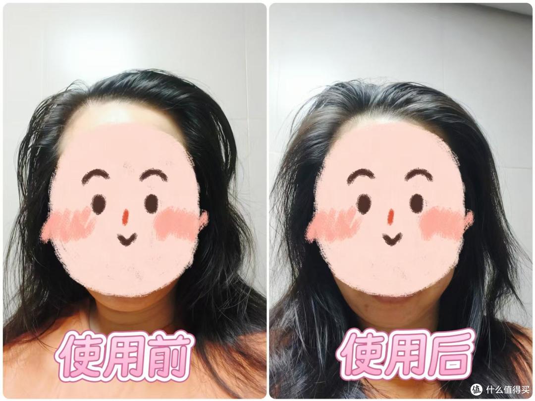 免洗头发喷雾哪个牌子好?拾宓温和去油打造自然高颅顶
