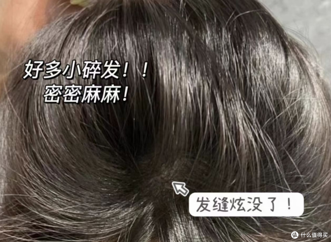 油头掉发星人，五款头皮护理产品真实使用记录