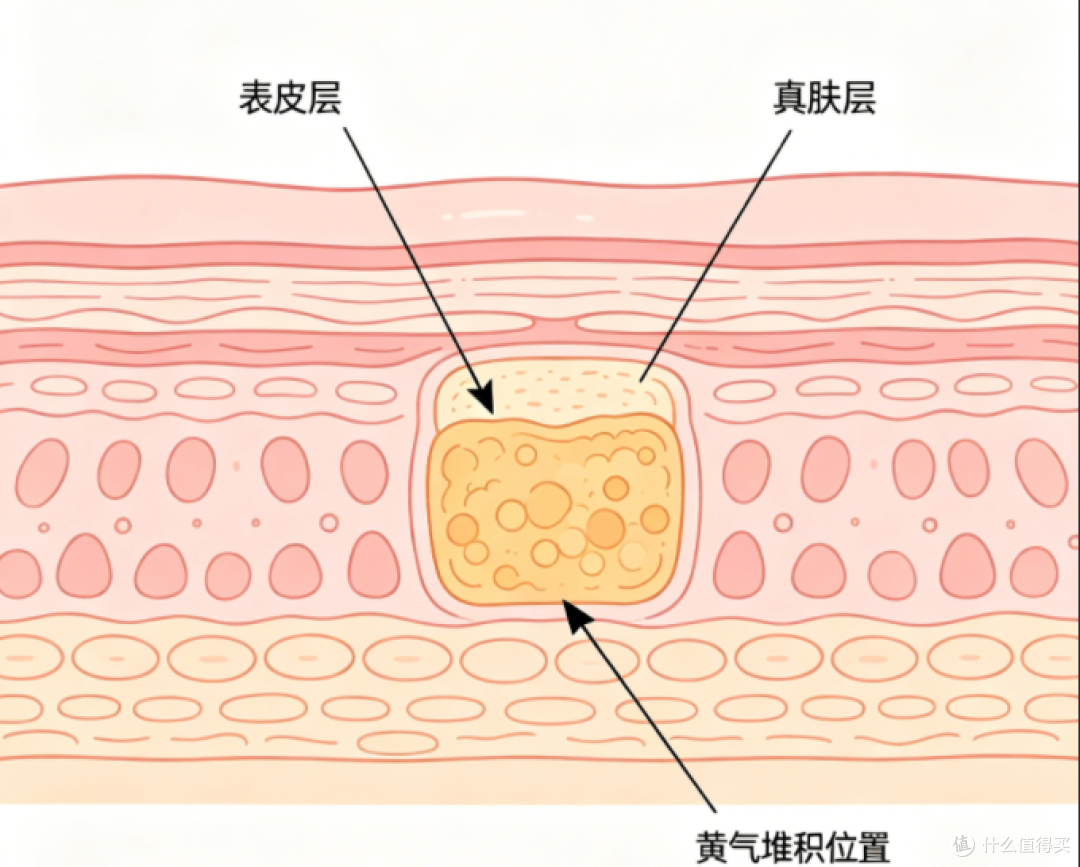 告别面部黄气,养出自然透亮好肤色