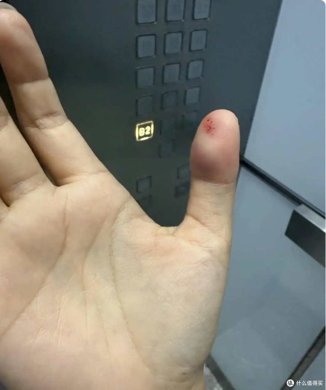 新能源汽车电吸门无防夹,苏州一位女士拇指被小米SU7夹骨折