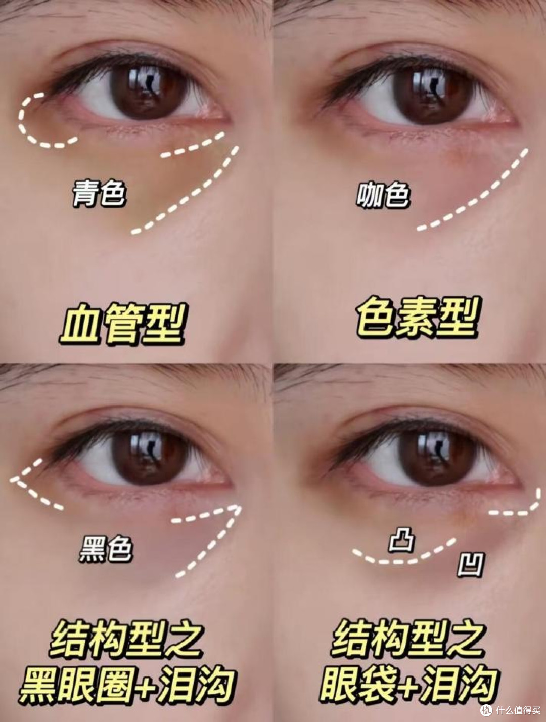 重度黑眼圈用眼膜真能去吗?不用担心!CA冻干眼膜靶向去黑还淡纹