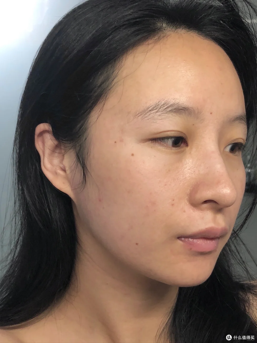 痘肌空瓶&用完一瓶说点实话