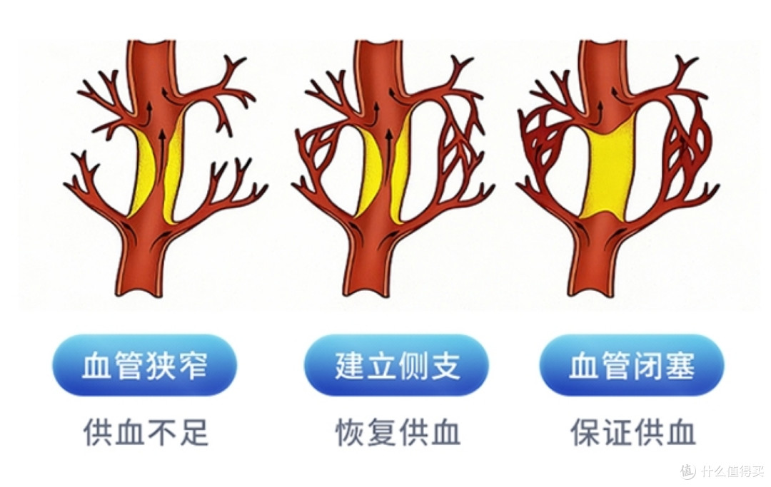 每天25分钟，爱奥乐缺血预适应训练仪帮你稳血压、呵护心血管