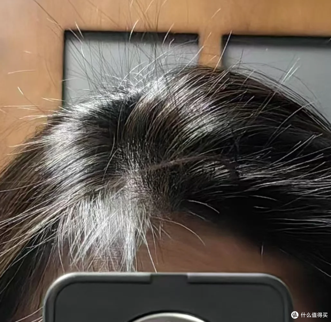 防脱育发洗发水哪个牌子最有效?按脱发类型成分科学推荐