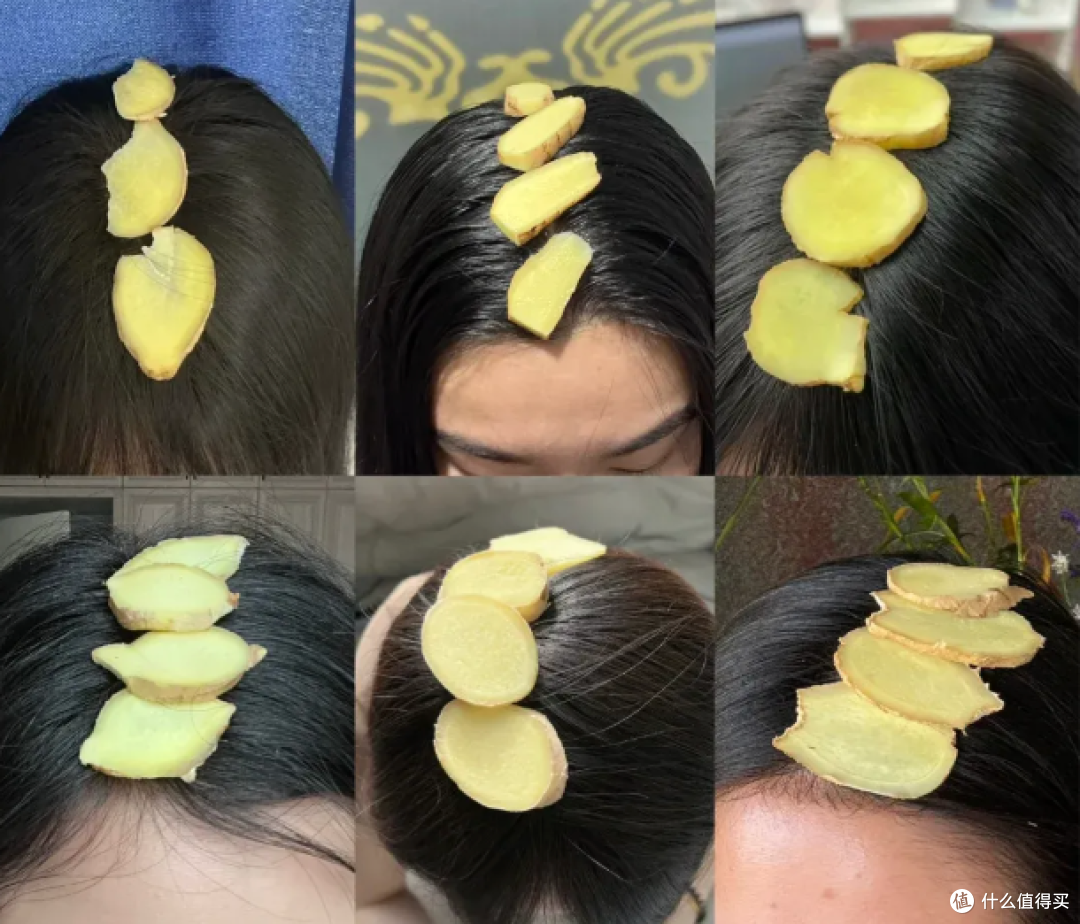 你和同事都在掉头发,但可能根本不是一种秃(建议收藏)