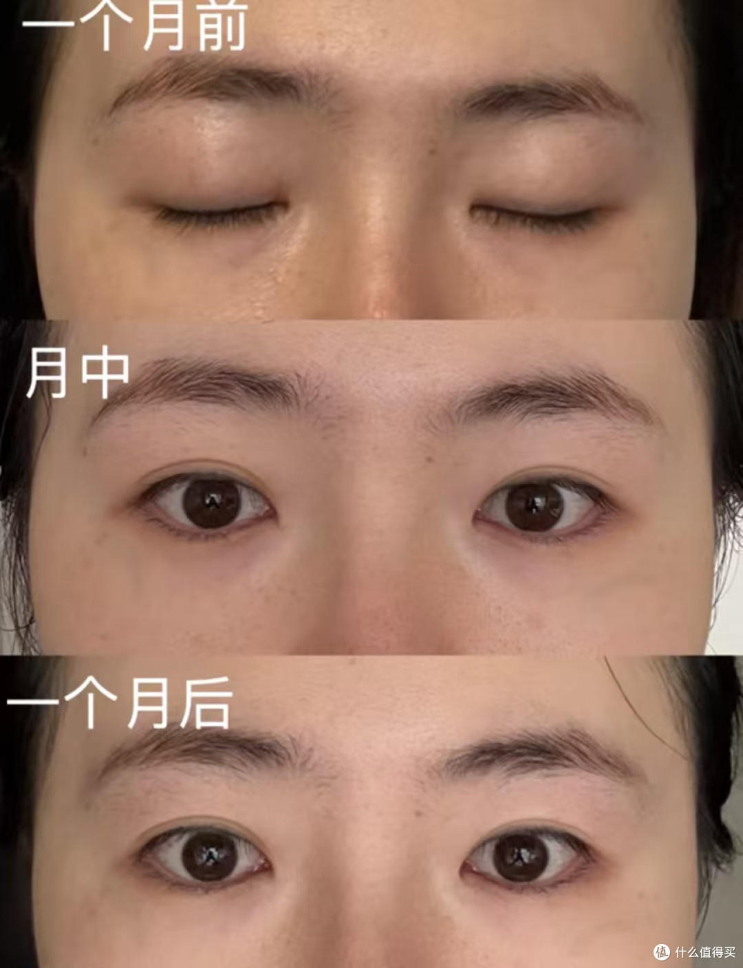 黑眼圈分类型吗?混合型黑眼圈怎么淡?CA冻干眼膜实测有效